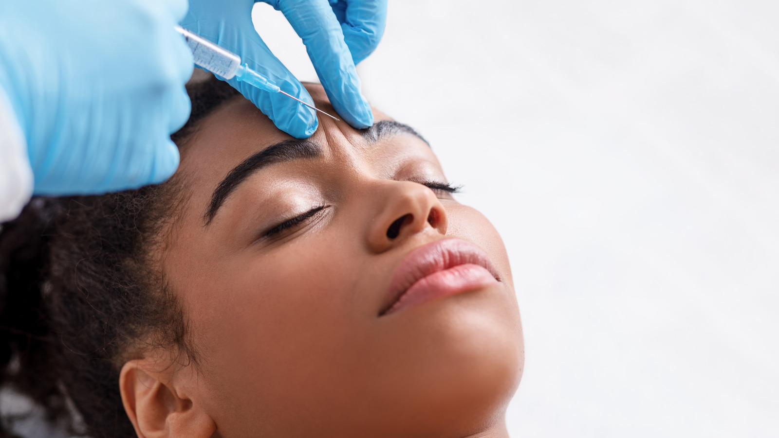 what-you-need-to-know-about-preventative-botox