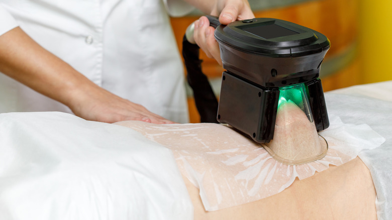 doctor giving a coolsculpting treatment