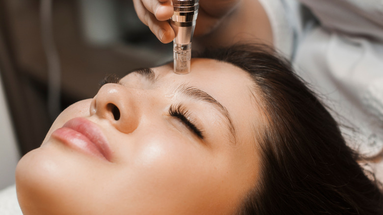 model receiving microneedling