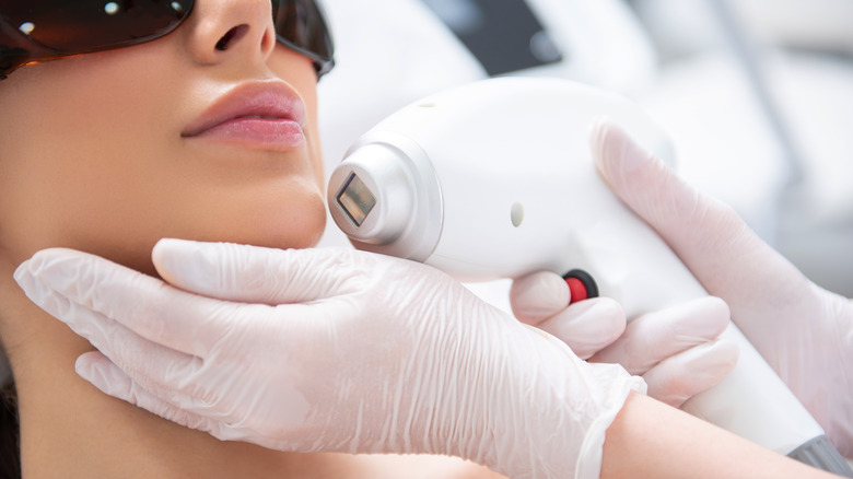 Patient receiving laser hair removal treatment on chin