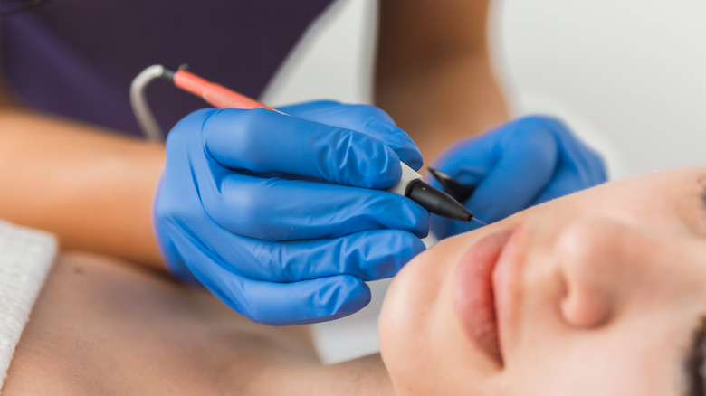 Electrologist removing hair from patient's cheek