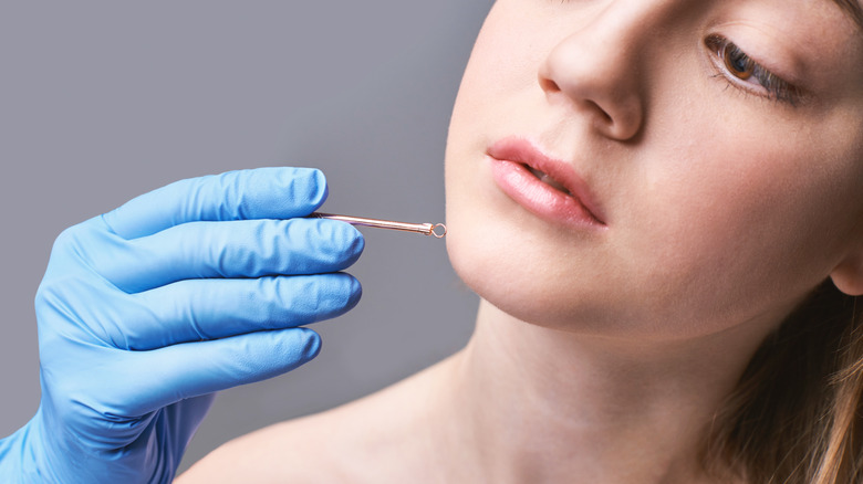 woman using an acne extractor