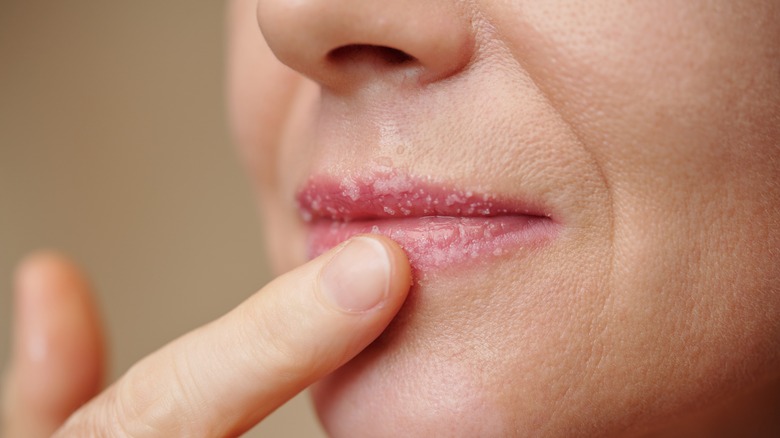 Woman applying lip scrub