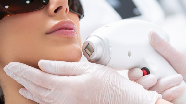 Laser hair removal on woman's chin