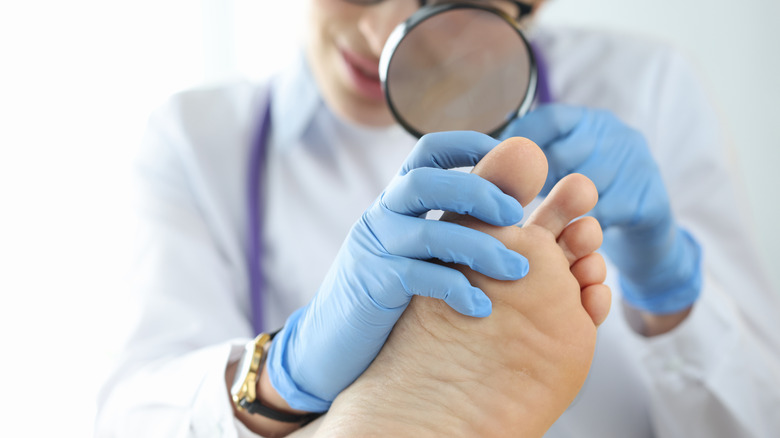 closeup of doctor examining a foot