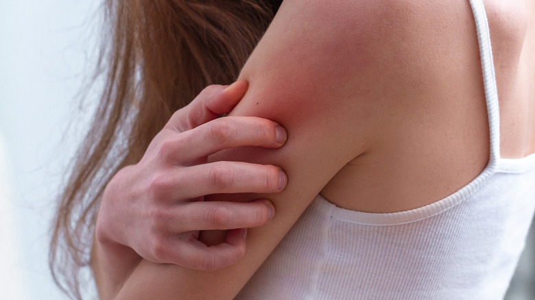 profile of woman itching her arm