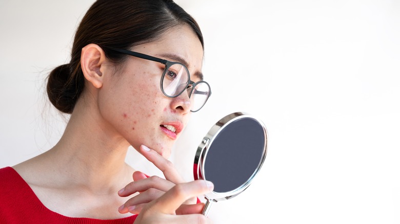 Woman looking at her acne in mirror