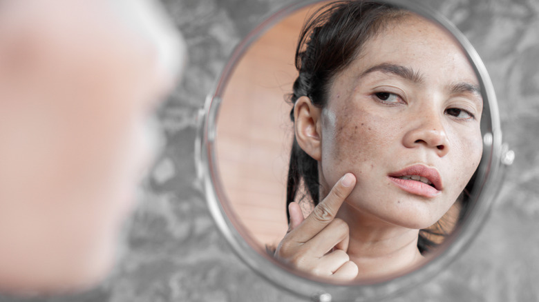 Woman pointing to acne in mirror