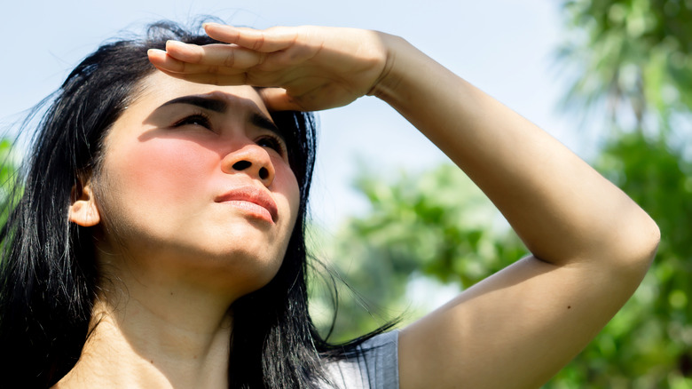 woman with sunburn