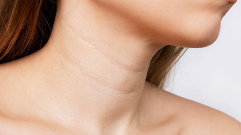 woman with neck lines