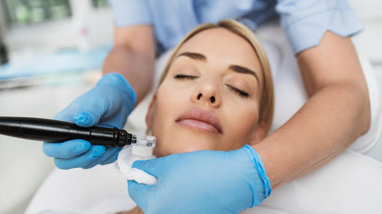 woman getting microneedling